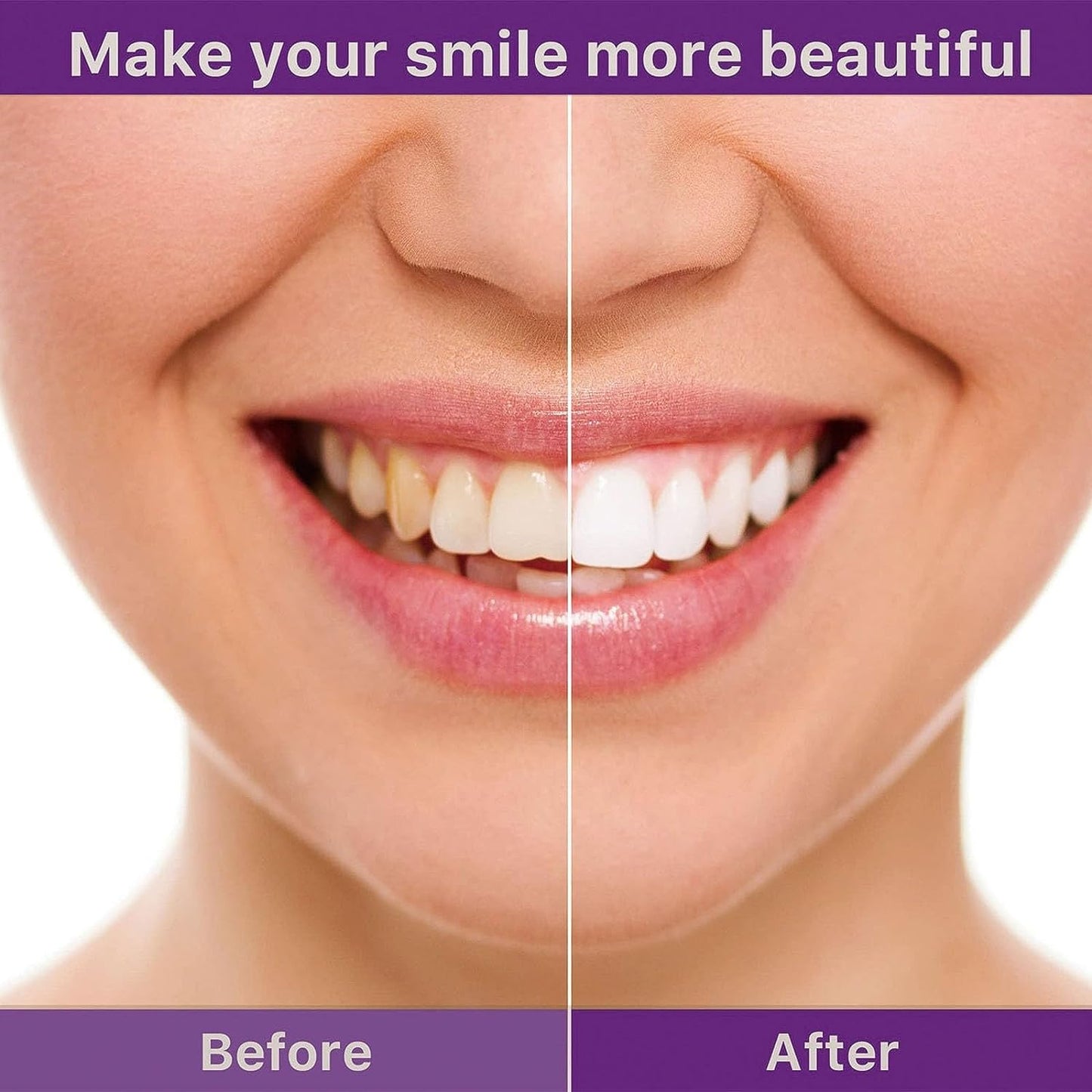 Hismile V34 Teeth Colour Correct Serum - Bforbazaar
