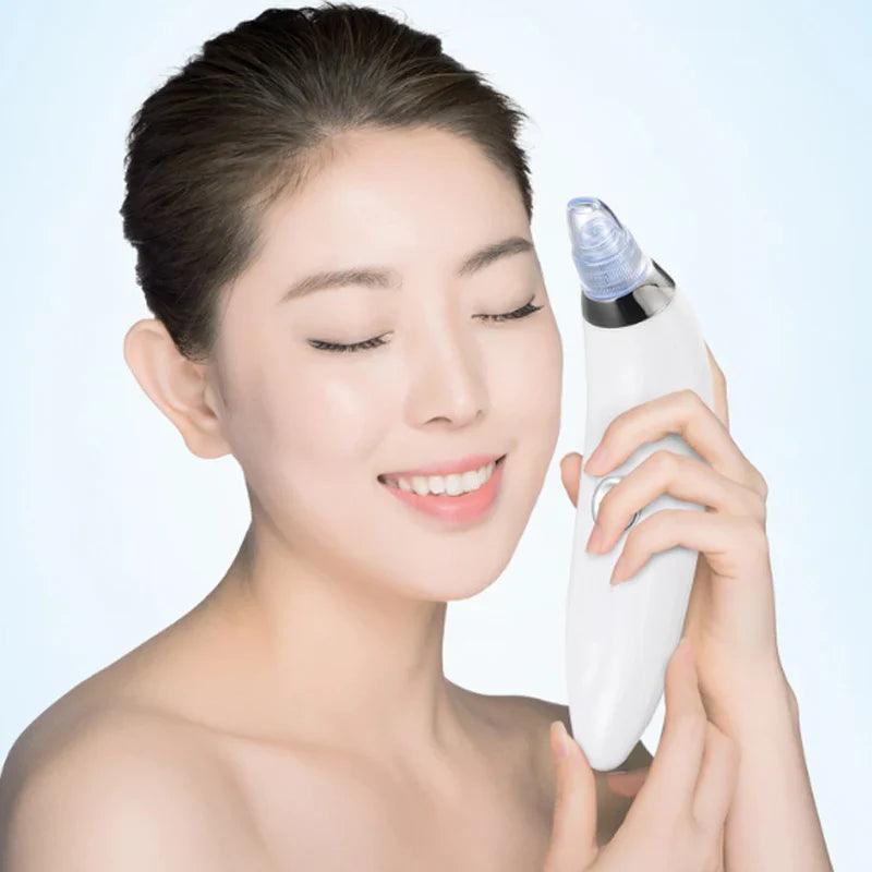 Blackhead And Acne Suction & Porescleaner - Bforbazaar