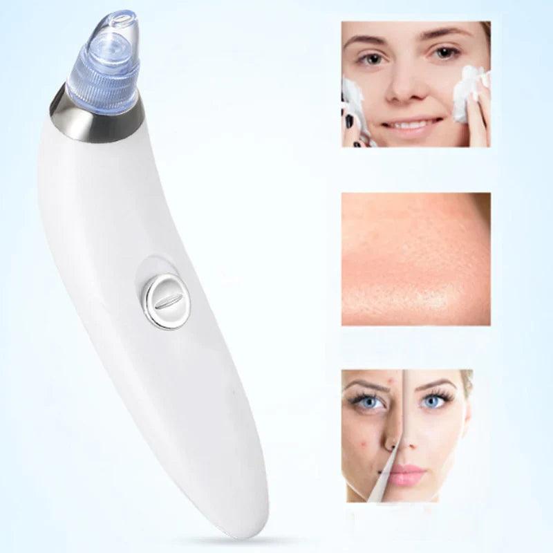 Blackhead And Acne Suction & Porescleaner - Bforbazaar
