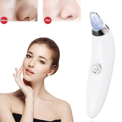 Blackhead And Acne Suction & Porescleaner - Bforbazaar