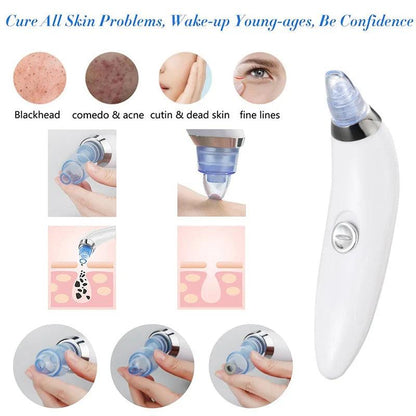 Blackhead And Acne Suction & Porescleaner - Bforbazaar