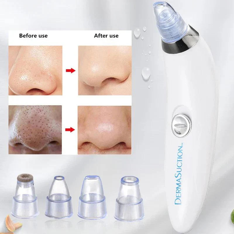 Blackhead and Acne Suction & PoresCleaner - Bforbazaar
